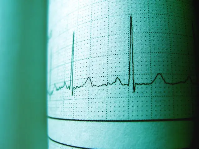 Representação Frequência Registros de um eletrocardiograma